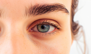 Understanding Under Eye Puffiness & Dark Circles: Causes, Concerns, and Solutions